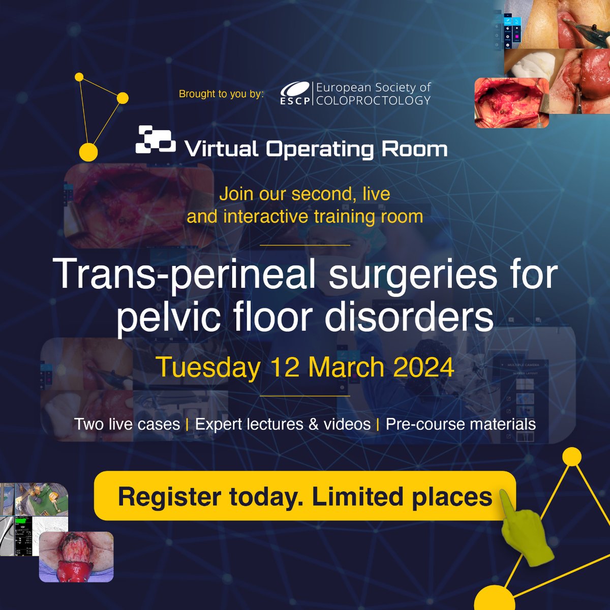 European Society of Coloproctology (@escp_tweets) on Twitter photo 🚨There's just 1 week left🚨
Places are limited so register now for the next visit to the Virtual Operating Room.
i.mtr.cool/cucamlhztj
#PelvicFloorSurgery #VirtualOR
<a href="/PFCNaldini/">Gabriele Naldini</a> <a href="/Dr_A_Sturiale/">Alessandro Sturiale</a> <a href="/ColorectalDis/">Colorectal Disease</a> <a href="/mia_imran_aslam/">Imran Aslam</a> <a href="/YouESCP/">Young ESCP</a> 🚨There's just 1 week left🚨
Places are limited so register now for the next visit to the Virtual Operating Room.
i.mtr.cool/cucamlhztj
#PelvicFloorSurgery #VirtualOR
<a href="/PFCNaldini/">Gabriele Naldini</a> <a href="/Dr_A_Sturiale/">Alessandro Sturiale</a> <a href="/ColorectalDis/">Colorectal Disease</a> <a href="/mia_imran_aslam/">Imran Aslam</a> <a href="/YouESCP/">Young ESCP</a>