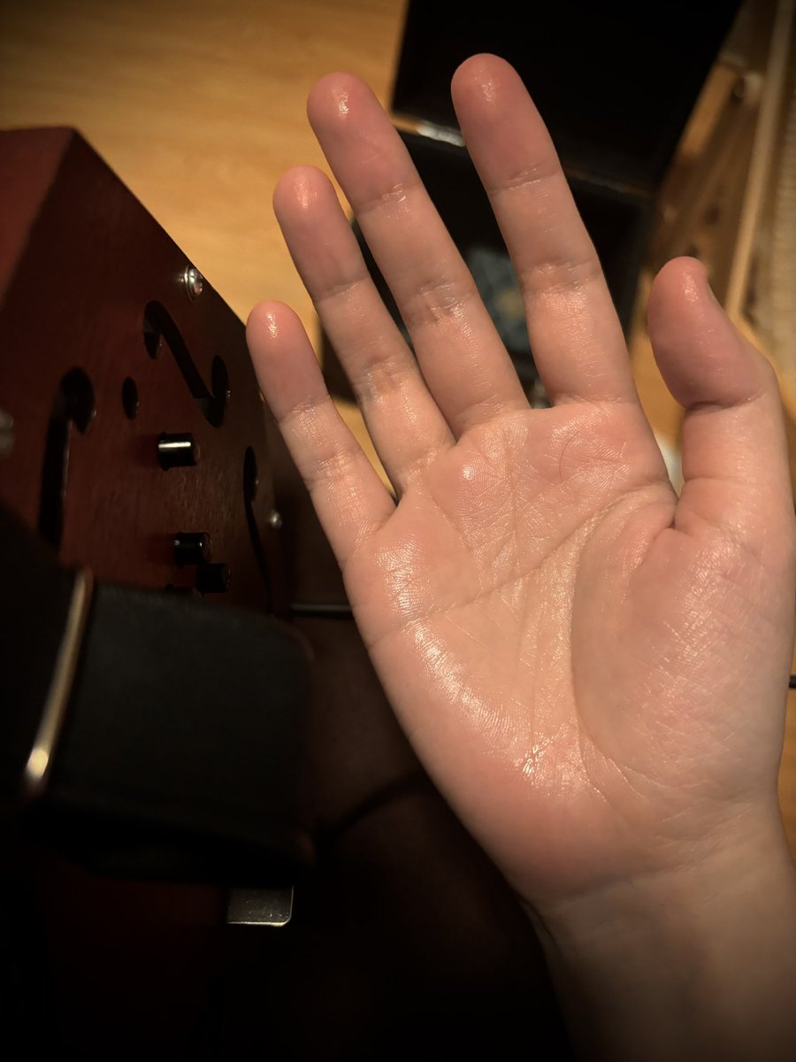 f_4_failure's tweet image. #100daysofpractice noob's journey Day 6

Hyperhidrosis gang🙄😩