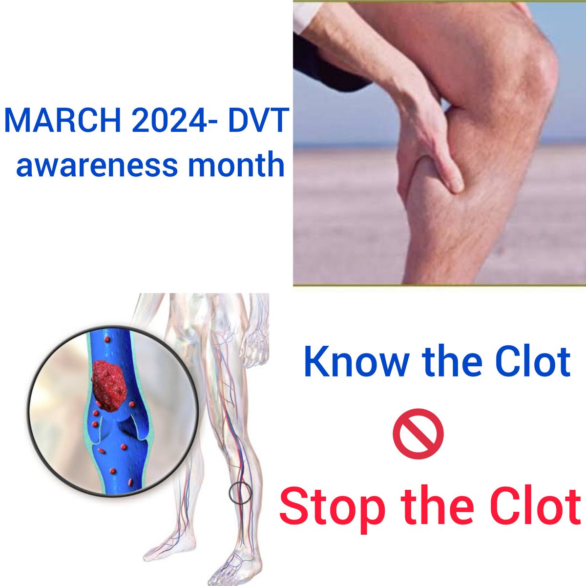 March is DVT awareness month! Early diagnosis-adequate management- reduce complications! #venousdisease #DVT #India #jammu 
#healthforall @PMOIndia @VascularSVS