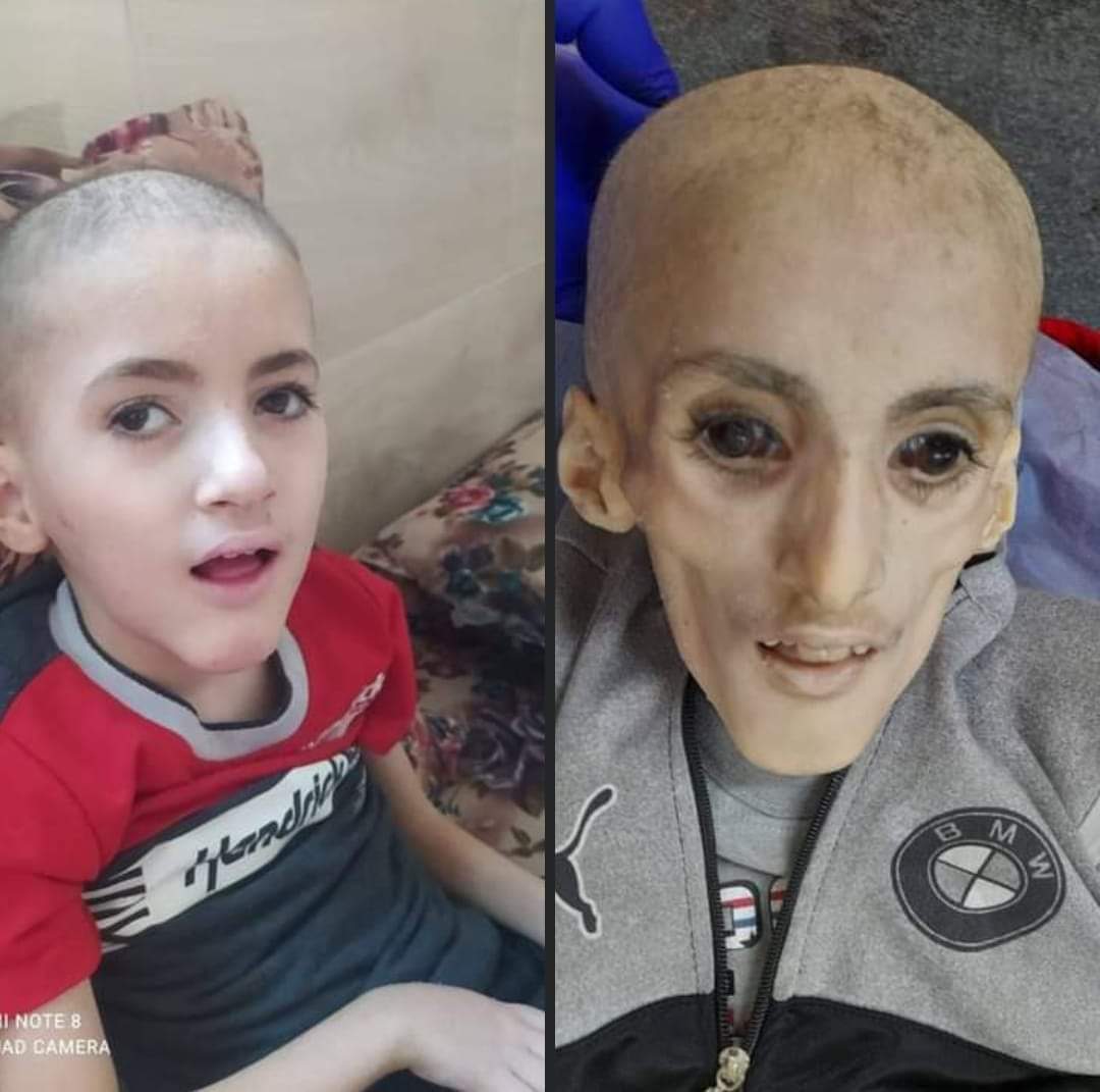 حسبنا الله ونعم الوكيل
لن ننسى ولن نسامح