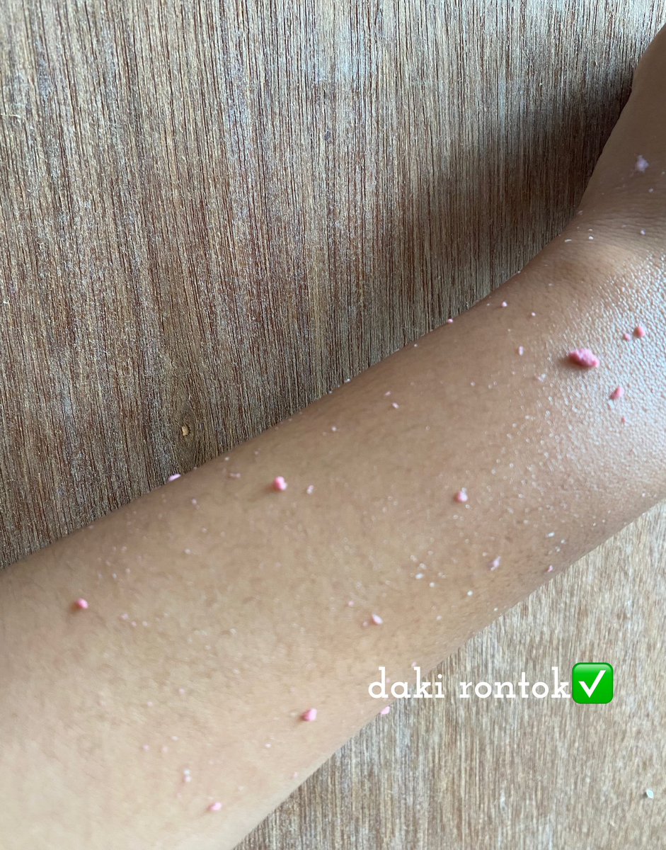 plumpypum's tweet image. DAKI RONTOK DALAM WAKTU 10 DETIK! 

UDAH GITU WANGINYA ITU LOH SUPER ENAK  😍

#pumereview