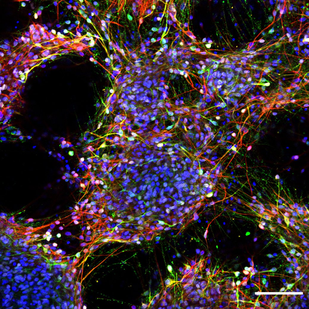 Targeting FZD5 to promote midbrain patterning

Read this Research Highlight showcasing work from Andy Yang <a href="/DeAndyYang/">Andy Yang</a>, Stephane Angers <a href="/StephAngers/">Stephane Angers</a> and colleagues <a href="/UofT/">University of Toronto</a>:

journals.biologists.com/dev/article/15…