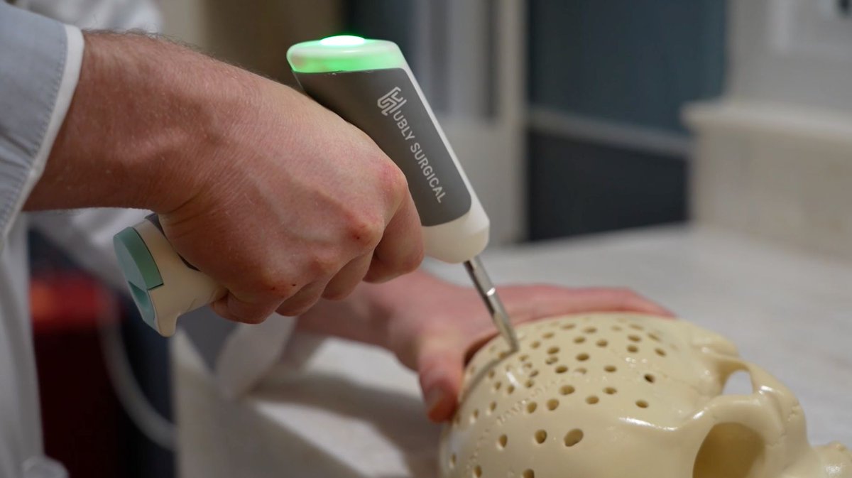NM Media Relations (@nmhc_news) on Twitter photo <a href="/NorthwesternU/">Northwestern</a> <a href="/BrainDrillGirl/">C</a> <a href="/NeurosurgeryNM/">Neurosurgery at NM</a> <a href="/NorthwesternMed/">Northwestern Medicine</a> In October, <a href="/MatthewPottsMD/">Matthew Potts</a> of <a href="/NeurosurgeryNM/">Neurosurgery at NM</a> <a href="/NorthwesternMed/">Northwestern Medicine</a> became the first surgeon in the U.S. to successfully use the drill to treat a patient with a #brainbleed.
PRESS RELEASE: buff.ly/3P84FiH <a href="/NorthwesternU/">Northwestern</a> <a href="/BrainDrillGirl/">C</a> <a href="/NeurosurgeryNM/">Neurosurgery at NM</a> <a href="/NorthwesternMed/">Northwestern Medicine</a> In October, <a href="/MatthewPottsMD/">Matthew Potts</a> of <a href="/NeurosurgeryNM/">Neurosurgery at NM</a> <a href="/NorthwesternMed/">Northwestern Medicine</a> became the first surgeon in the U.S. to successfully use the drill to treat a patient with a #brainbleed.
PRESS RELEASE: buff.ly/3P84FiH