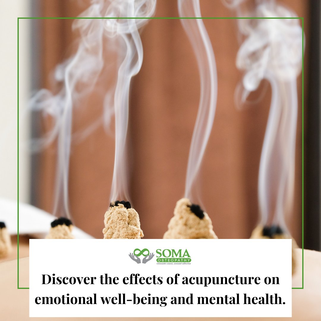 Discover the effects of acupuncture on emotional well-being and mental health.

Visit our website somaosteopathy.com to learn more!

#Osteopathy #HealthyGrowt #Development #HolisticApproach #PreventAndManageConditions #SupportImmuneSystem #CollaborativeCare #Pedi