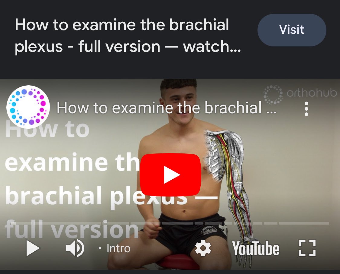 TJQPNI's tweet image. Don’t know your suprascapular from your upper and lower subscapular nerves? @OrthohubXYZ gotcha covered : m.youtube.com/watch?v=G0LYQu… #brachialplexus #mervenerds