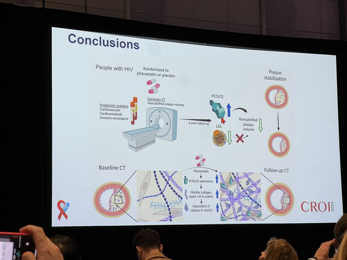 Great presentation on a subset study from REPRIEVE. Statin utilization in PWH #CROI2024