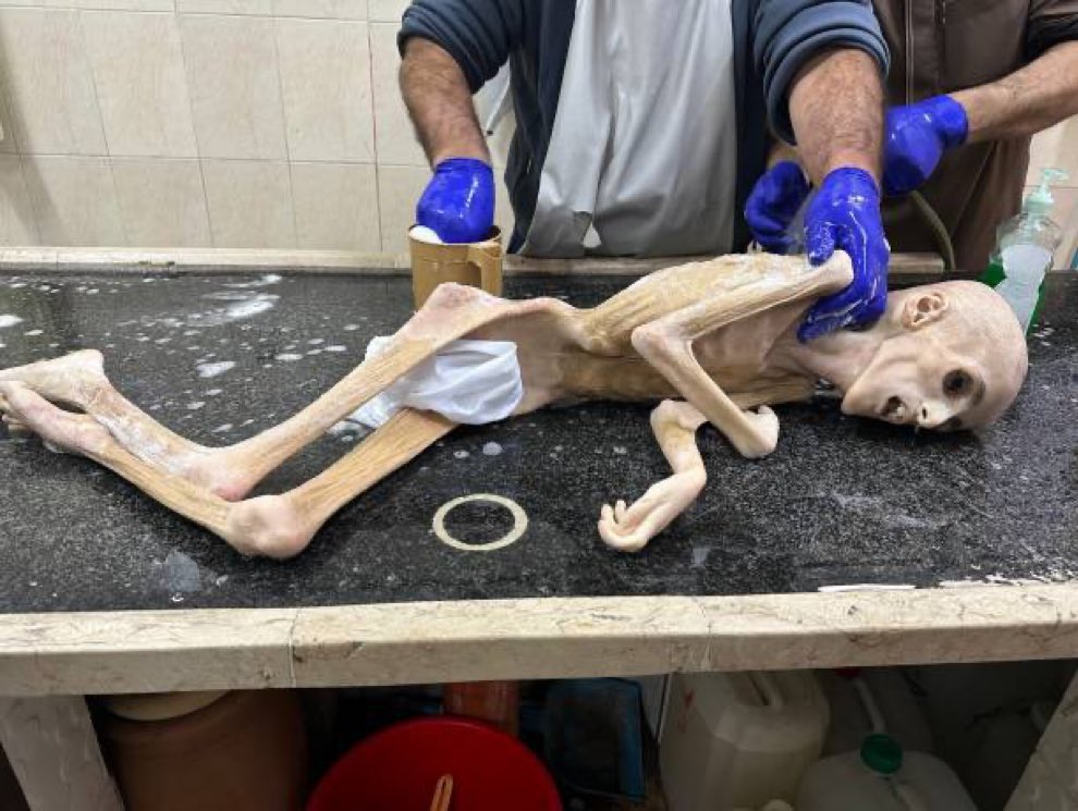 drhossamsamy65's tweet photo. هذا مافعلته إسرائيل وأمريكا والعرب في أطفال غزة😭

This is what Israel and America and the Arabs did to the children of Gaza!

C'est ce qu'Israël et l'Amérique ont fait aux enfants de Gaza!

Esto es lo que Israel y Estados Unidos hicieron con los niños de Gaza

İsrail ve Amerika'nın Gazze çocuklarına yaptığı buydu