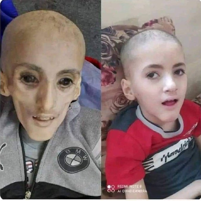 ده يزن 
يزن مات من الجوع 
بس 
كملوا حياتكم عادي