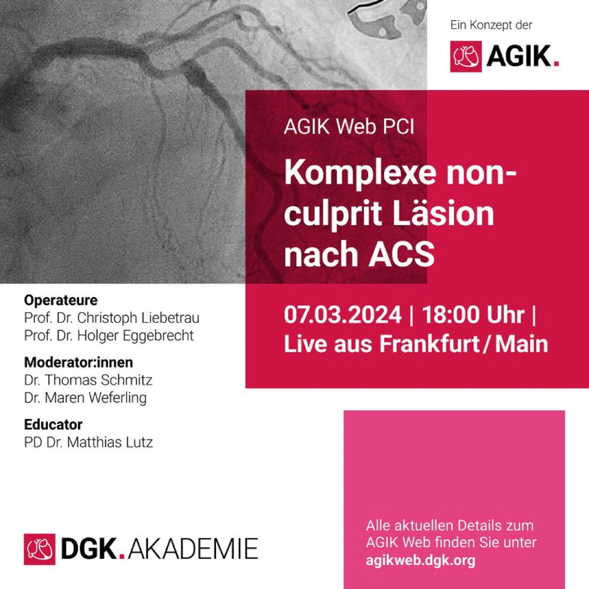 #AGIKwebPCI live und (teilweise) in Farbe (und bisschen schwarzweiss)
➡️ComplexNonCulpritPCI⬅️
🗓️07.03.204 I 18:00 CET
🔗 agikweb.dgk.org/livestream/

#WIRsindAGIK <a href="/AGIKinterv/">AGIK</a>
