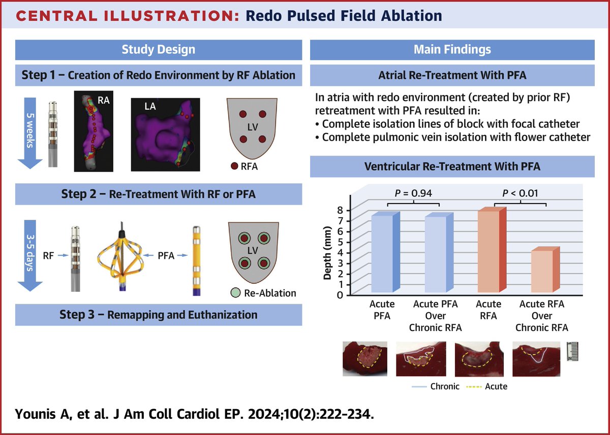 #PFA is highly efficient for #epAblation following prior #RFA, which may be beneficial in pts presenting for redo procedures. In the ventricle, PFA resulted in lesions that are deeper than RFA when ablating over chronic superficial RFA lesions. bit.ly/3Tl80h2 #JACCCEP