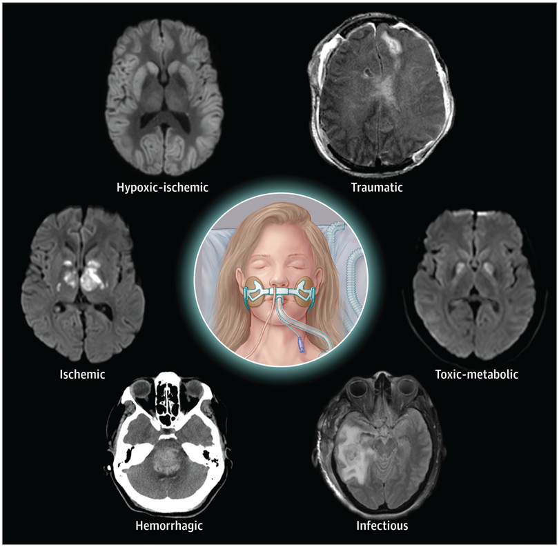 Review article illustrates the current, and likely future, landscapes of prognostic markers of neurologic recovery from disorders of consciousness caused by severe, acute brain injury. ja.ma/3P8kCpg