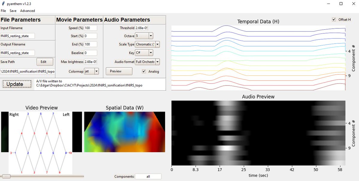 Edgar Guevara (@guevaracodina) on Twitter photo Just audiovisualized #fNIRS data for the first time using the amazing tool #PyAnthem from <a href="/HillmanLab/">Elizabeth M. C. Hillman</a>. Exciting and groundbreaking work!
youtu.be/3NsrkbzQsNk Just audiovisualized #fNIRS data for the first time using the amazing tool #PyAnthem from <a href="/HillmanLab/">Elizabeth M. C. Hillman</a>. Exciting and groundbreaking work!
youtu.be/3NsrkbzQsNk