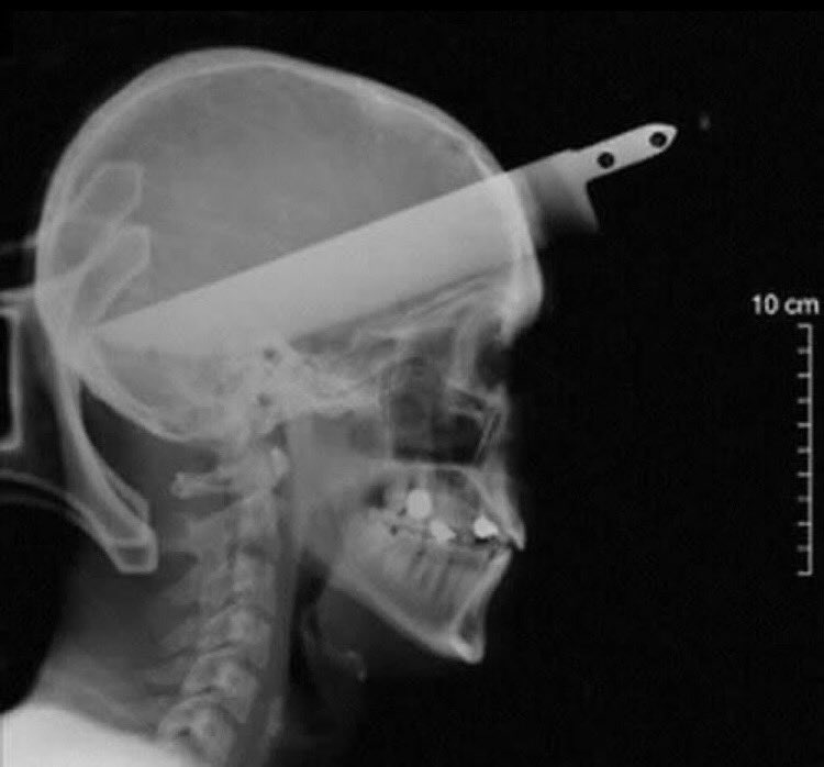 nuovo piercing domani