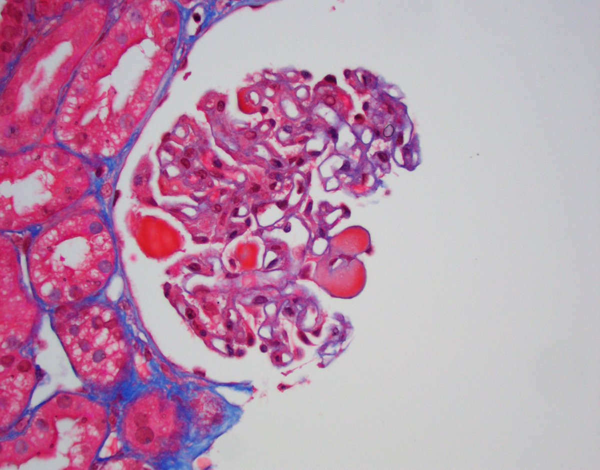 JZRenalPath tweet picture