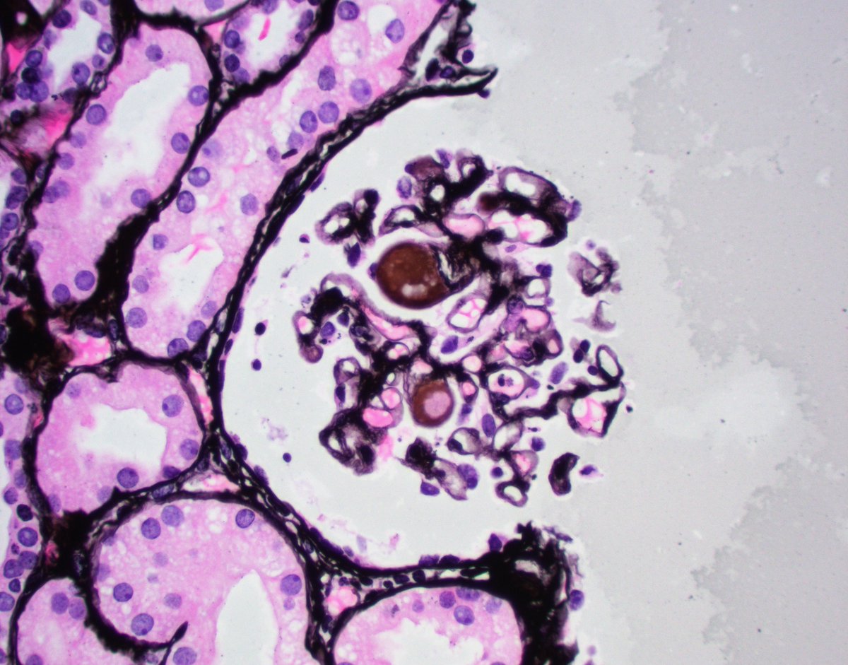 JZRenalPath tweet picture