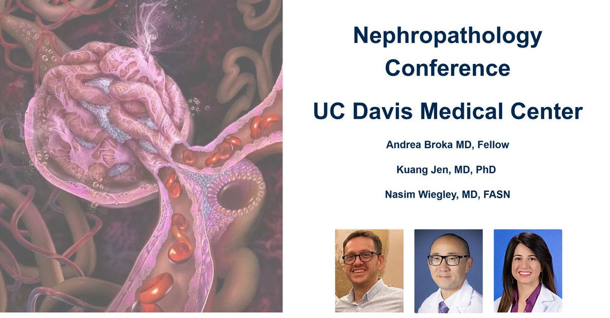 Another #Nephropathology conference @UCDavisMedCntr today with great discussion on a rare case lead by @AndreaBroka (Nephrology Fellow), @KidneyPath (Pathologist) & @NWiegley (Nephrologist). #NephTwitter #RenalPath # PathTwitter