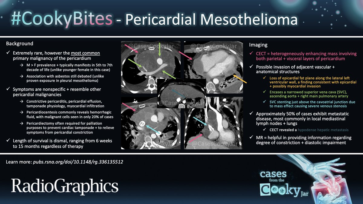 Answer: Pericardial Mesothelioma Learn more: 🔗pubs.rsna.org/doi/10.1148/rg… #CookyBites #153 #RGphx @cookyscan1 @RadioGraphics