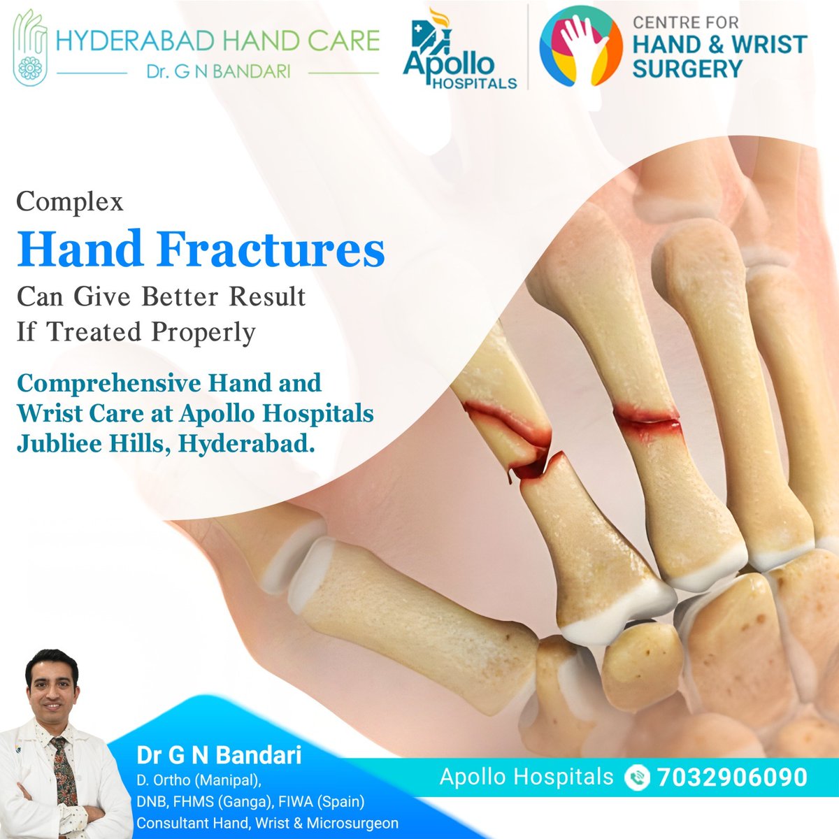 DrGNBandari's tweet image. Complex #HandFractures
Can give better results If #treated properly.Get comprehensive hand and wrist care at #ApolloHospitals, #JubileeHills, #Hyderabad.
Let us help you find relief. 🖐️💼
 
For more visit :      
hyderabadhandcare.com