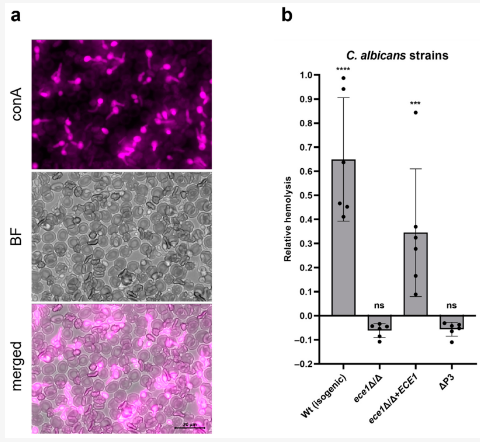 Toxins_MDPI's tweet image. #mdpitoxins Editor’s Choice Articles🔍 
🛎️"#Candidalysin Is the Hemolytic Factor of Candida albicans" by Prof. Bernhard Hube et al. 
👉Link: mdpi.com/2008114
