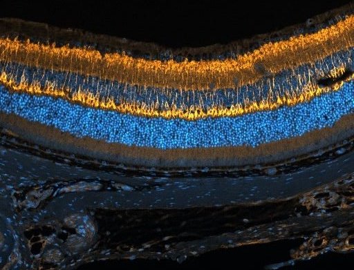 JacobLCar's tweet image. Having fun this week imaging some retina 👁️🐀You can see the nuclei (cyan) and bipolar cells (orange) from the mouse retina #Microscopy #retina