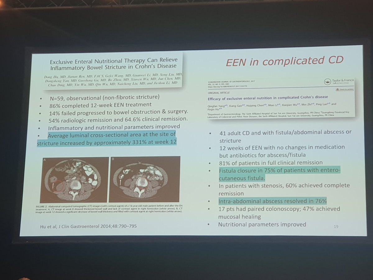 Exclusive enteral nutrition has a therapeutic role in complicated Crohn's disease #ECCO24