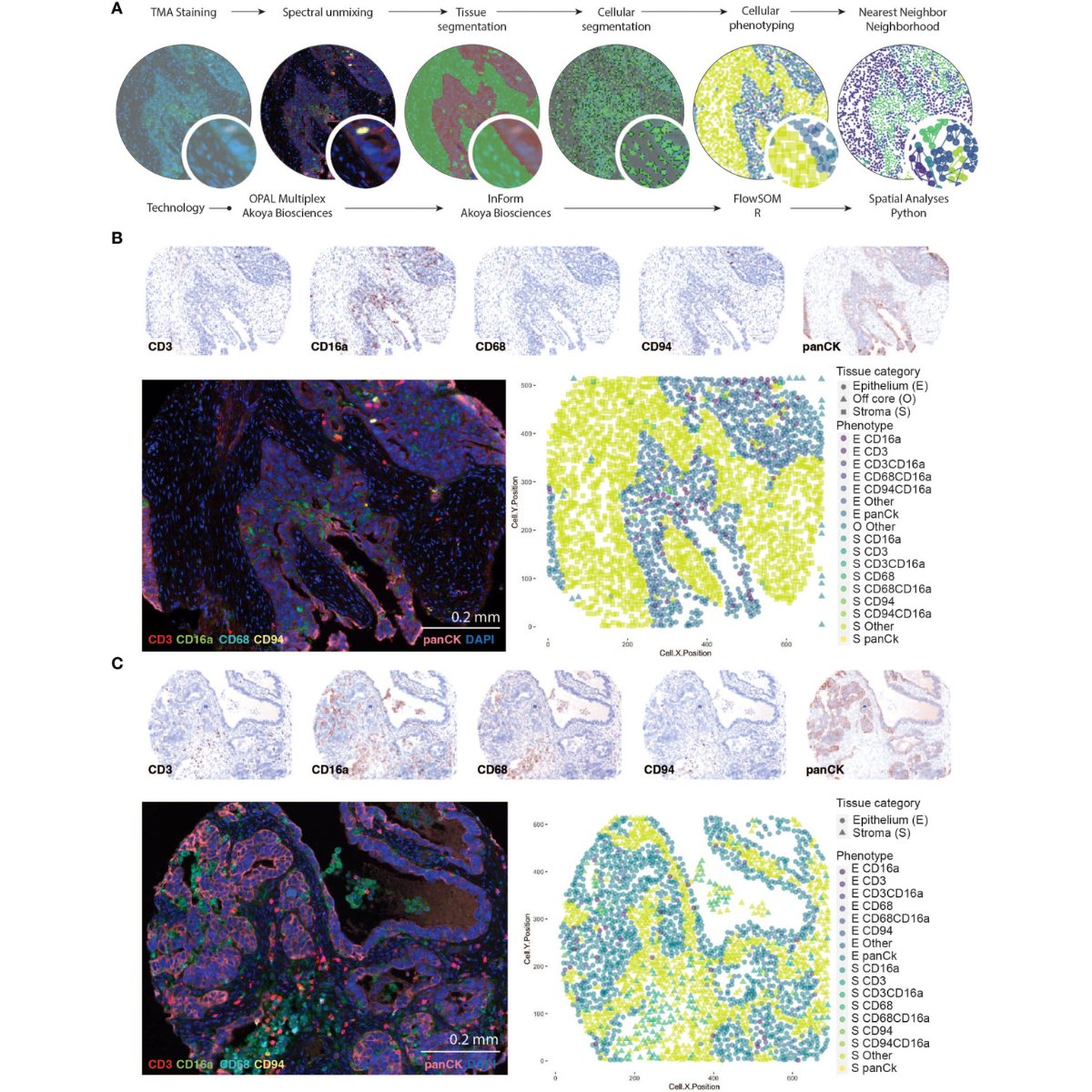 AkoyaBio's tweet photo. 🎉 Congrats to @NersesianSarah from @JeanetteEB's lab at @Dalhousieu on leading a great study on high-grade serous carcinoma of the ovary (#HGSC) using our #PhenoImager solution to analyze tumor immune cell inﬁltration and localization patterns & their associations w/ clinical features! https://t.co/arO7JBvuWx

#FridayRead #SpatialBiology