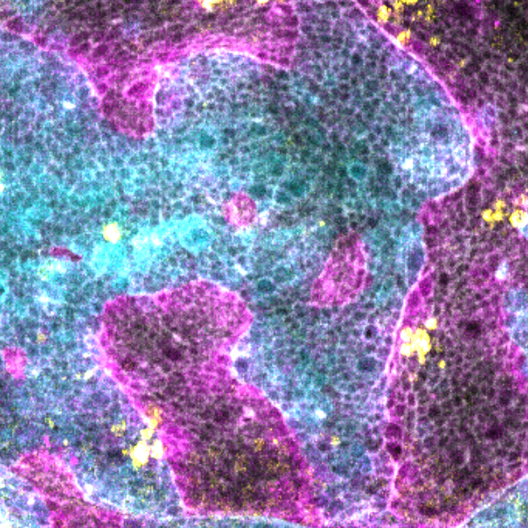 Classenlab (@classenlab) on Twitter photo Have you ever wondered how our tissues stay healthy, and how they are able to identify and remove abnormal cells?
Click authors.elsevier.com/sd/article/S09… <a href="/CurrentBiology/">Current Biology</a> for the whole story. 1/9
#devbio #cellbio #tumor #axonguidance #cellcompetition #SFB850 #Ras #Drosophila #JNK #teneurin Have you ever wondered how our tissues stay healthy, and how they are able to identify and remove abnormal cells?
Click authors.elsevier.com/sd/article/S09… <a href="/CurrentBiology/">Current Biology</a> for the whole story. 1/9
#devbio #cellbio #tumor #axonguidance #cellcompetition #SFB850 #Ras #Drosophila #JNK #teneurin