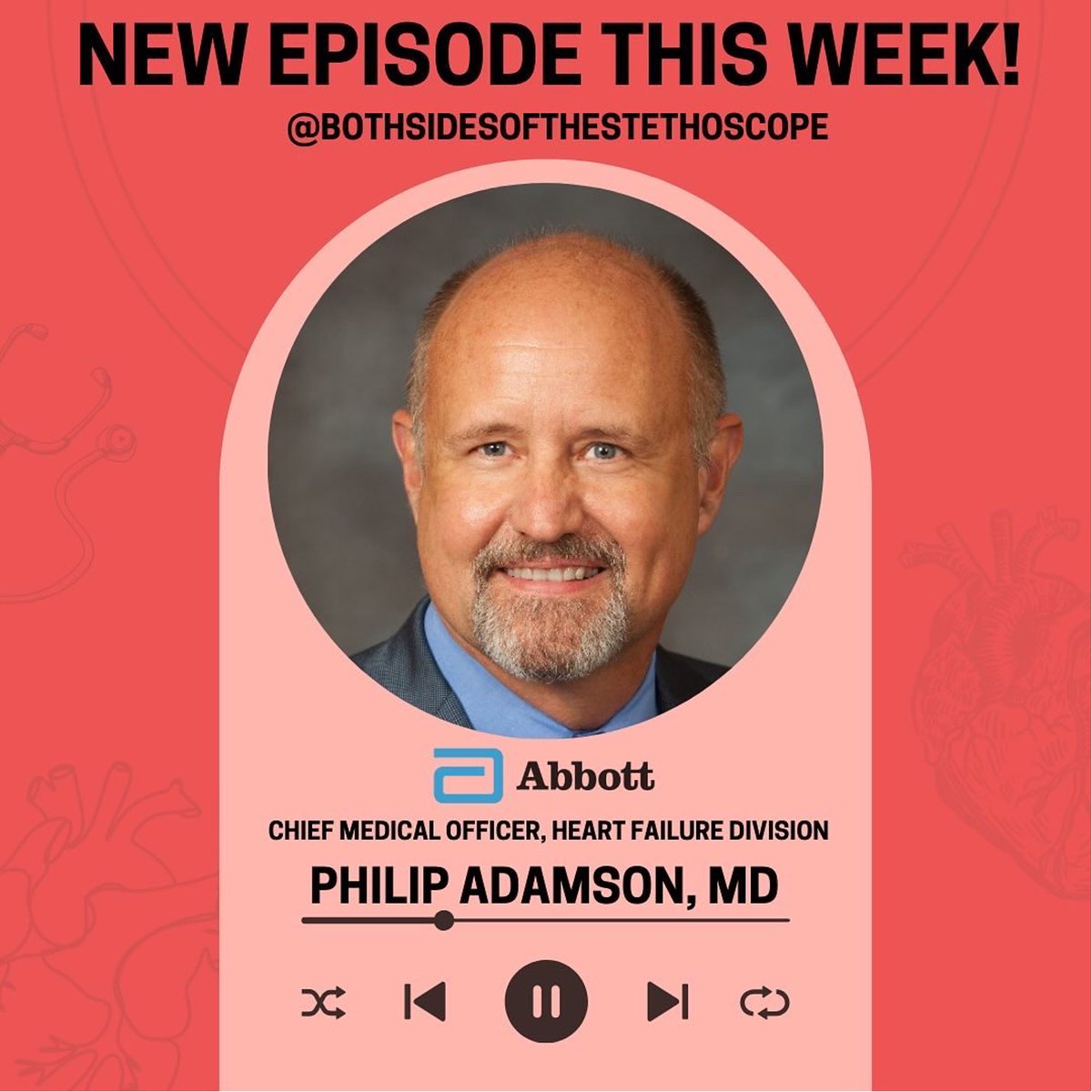Abbott Cardiovascular (@abbottcardio) on Twitter photo Listen to our own Dr. Philip Adamson on this episode of <a href="/bsotstethoscope/">BothSidesOfTheStethoscope</a>, hosted by Drs. Alin Gragossian and Colby Salerno, as they discuss common #HeartFailure patient inquiries, success stories, and more: open.spotify.com/episode/5pyh4K…
US Safety Info: bit.ly/3UmuGhV
#BSOTS Listen to our own Dr. Philip Adamson on this episode of <a href="/bsotstethoscope/">BothSidesOfTheStethoscope</a>, hosted by Drs. Alin Gragossian and Colby Salerno, as they discuss common #HeartFailure patient inquiries, success stories, and more: open.spotify.com/episode/5pyh4K…
US Safety Info: bit.ly/3UmuGhV
#BSOTS