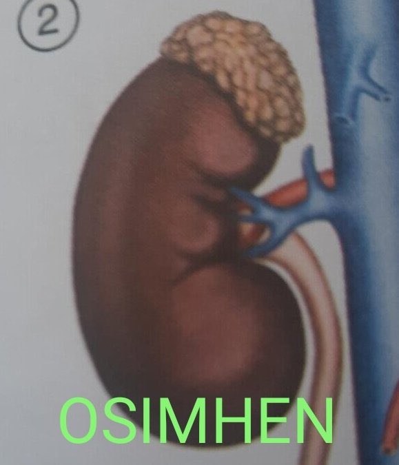 Dos días han pasado y sigo jodido porque nos marcó gol este tío