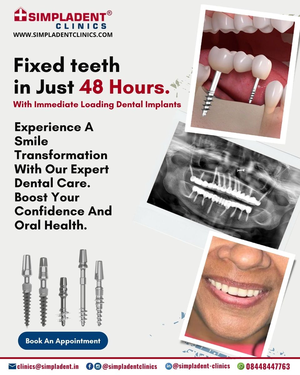 SimpladentC's tweet image. ✨Fixed Teeth In Just 48 HOurs With Immediate Loading Dental Implants ‼

Book An Appointment Today. 👇
📞 +91-8448447763
✉ clinics@simpladent.in
🌐 simpladentclinics.com
📍 g.page/r/CZdJVQ-8OsDd…

#simpladentclinics #48HourTeeth #ImmediateLoadingImplants #SmileTransformation