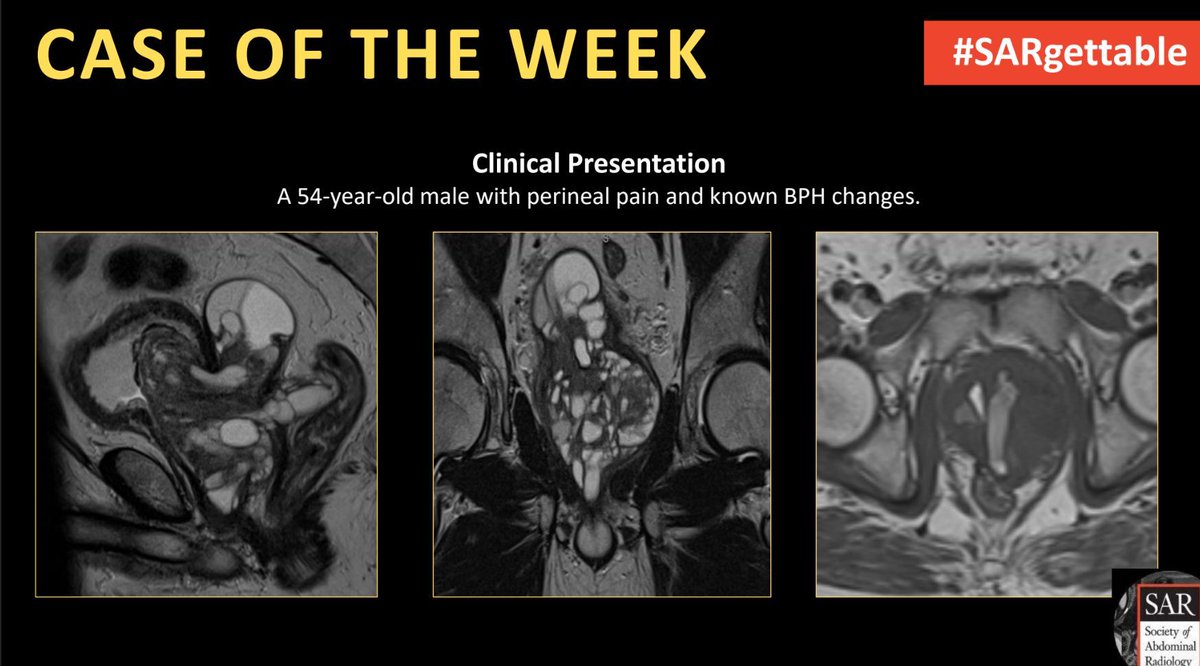 It's time for a new #SARgettable case of the week contributed by @AndreaEsqXR. Comment with your diagnosis down below!