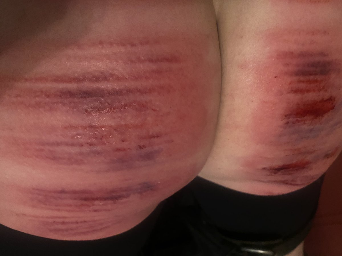 vonnie_aka_MB's tweet photo. ENGLAND 2024 FIST &amp; CANE TOUR
“R”, 32 stroke judicial caning from cold. One penalty stroke was delivered as well. 
Happy Topspace face pic included, because I loved caning you and you delight me, R. https://t.co/ZcNcC7B6uO
