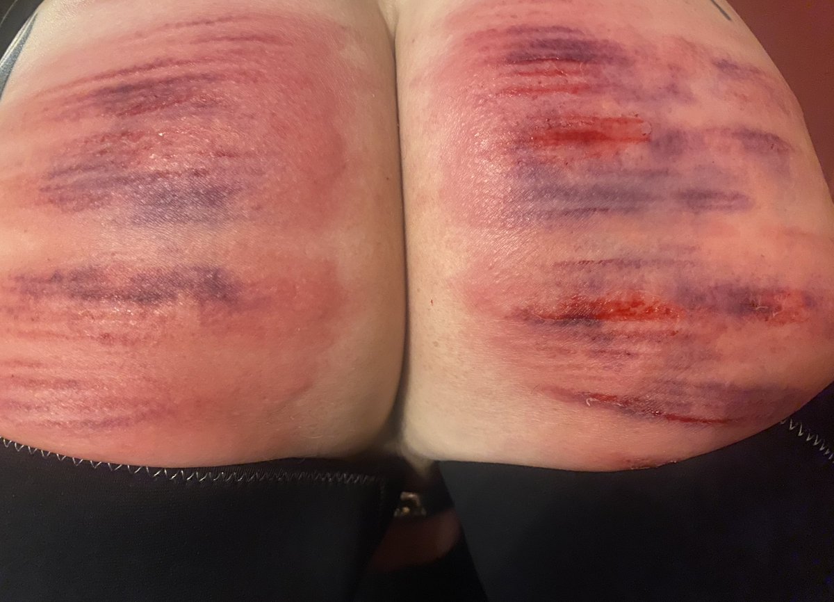 vonnie_aka_MB's tweet photo. ENGLAND 2024 FIST &amp; CANE TOUR
“R”, 32 stroke judicial caning from cold. One penalty stroke was delivered as well. 
Happy Topspace face pic included, because I loved caning you and you delight me, R. https://t.co/ZcNcC7B6uO