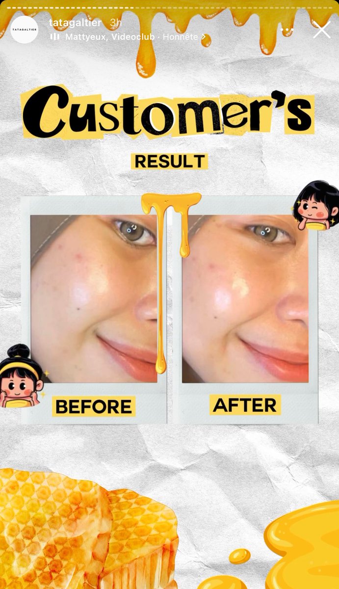 sunflwrsuu's tweet image. thank youuuu @tatagaltier @aushmilby for making my dream come true!! ⛅️☀️✨🫶🏻

#tehsunny #spillthetea💦