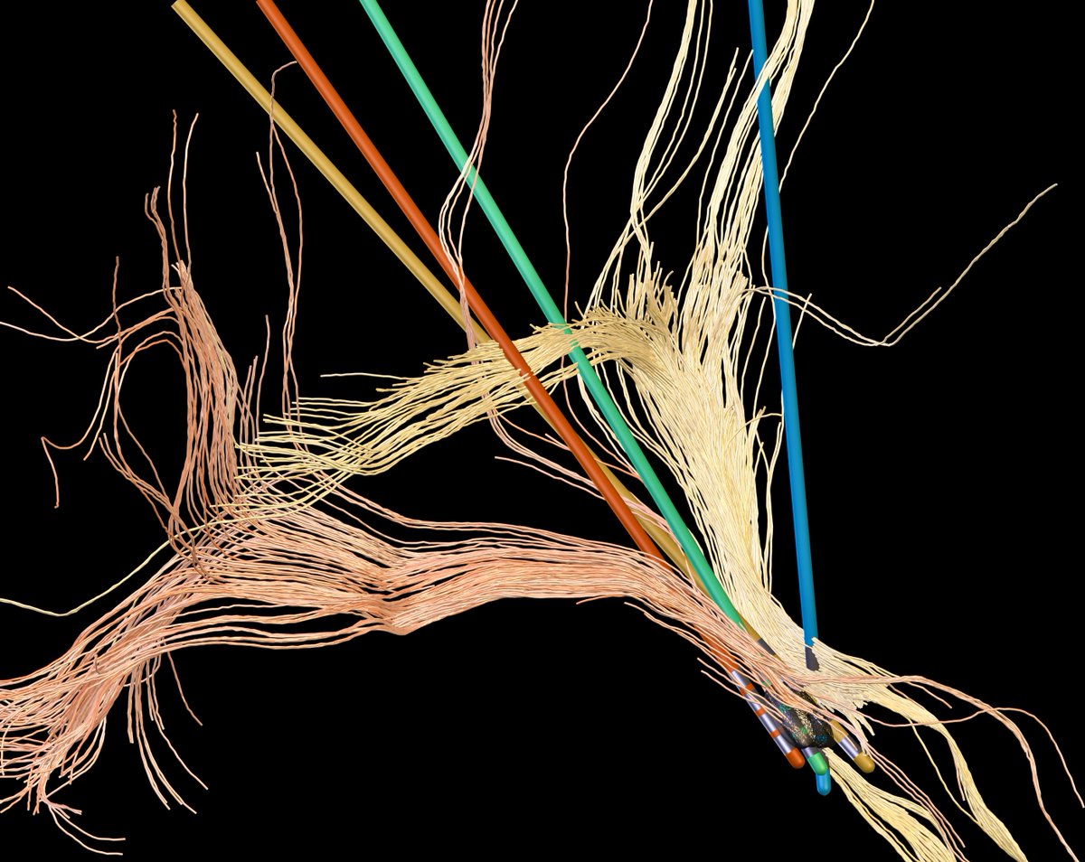 Thanks for the fantastic feedback on our paper, everyone. We are over the moon! 💫 In case you are interested but you lack the time to read the entire thing, we wrote a one-page summary for @NatureNeuro that is freely available here: rdcu.be/dzqw2