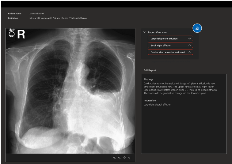 Matthew Lungren MD MPH (@mattlungrenmd) on Twitter photo Vision-Language Models will revolutionize radiology and enhance patient care.
How do we ensure they achieve their goals in practice?
Latest research from <a href="/MSFTResearch/">Microsoft Research</a> led by @runmiridliy explores clinician+AI interaction for VLMs in healthcare!
lnkd.in/gQv6RNq4 Vision-Language Models will revolutionize radiology and enhance patient care.
How do we ensure they achieve their goals in practice?
Latest research from <a href="/MSFTResearch/">Microsoft Research</a> led by @runmiridliy explores clinician+AI interaction for VLMs in healthcare!
lnkd.in/gQv6RNq4