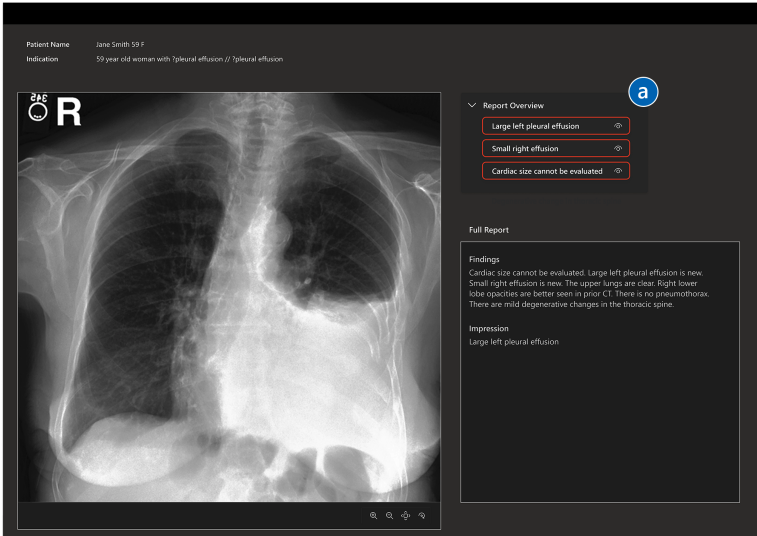 Vision-Language Models will revolutionize radiology and enhance patient care. How do we ensure they achieve their goals in practice? Latest research from @MSFTResearch led by @runmiridliy explores clinician+AI interaction for VLMs in healthcare! lnkd.in/gQv6RNq4