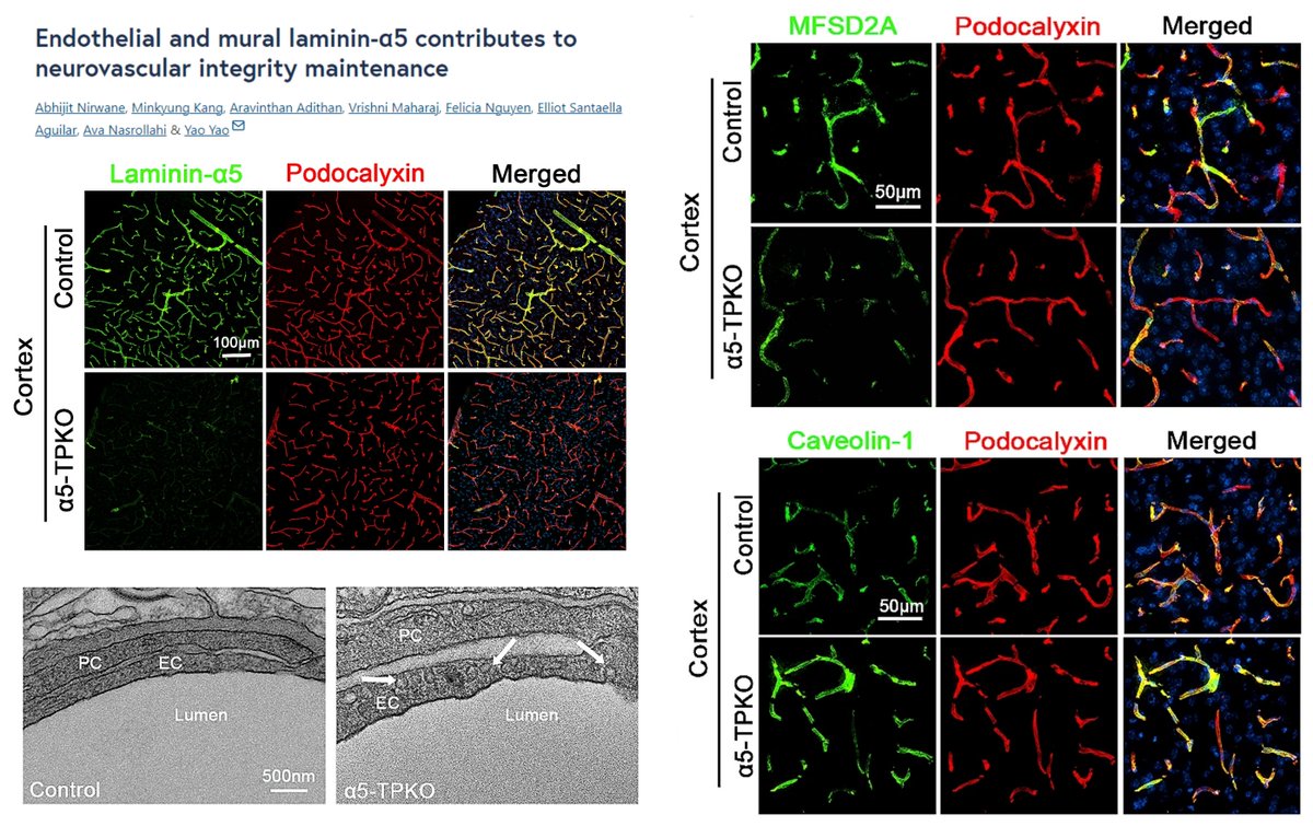 Loss of Lamininα5 from Both Tie2+ #EndothelialCell & PDGFRβ+ #Pericyte compromises #BloodBrainBarrier #BBB

Intact #TightJunction
Intact AQP4+ Astrocyte endfeet
⏫#Transcytosis ⏫Cav1 ⏬MFSD2A
⏬🧠pericyte
Despite unaltered microvessel density/branching, Lama5 mutant seems to…