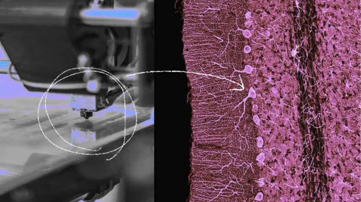 Scientists created the first 3D-printed brain organoids that exhibit functions akin to natural brain tissue. In this study, the UWM team coaxed stem cells into developing different brain cell types, creating a printable “bioink” by mixing these cells with a hydrogel.
