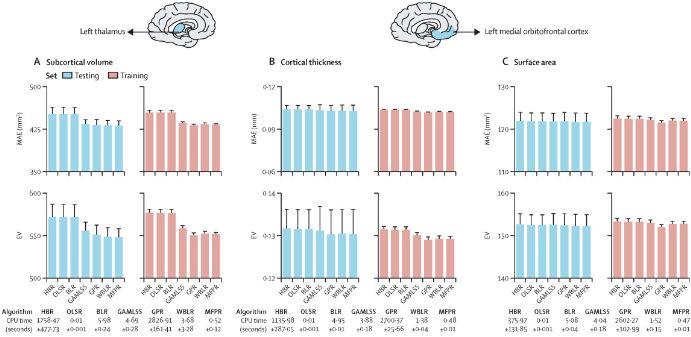 Our first Resources paper is now live! Resources aim to highlight the generation and availability of robust datasets, data resources, innovative methods and tools for use in clinical settings. Normative modelling of brain morphometry, @Frangougroup: buff.ly/3US7UyG