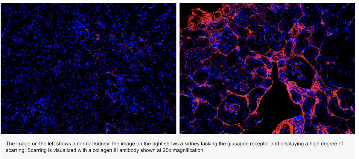 Glucagon, a hormone best known for promoting blood sugar production in the liver, also appears to play a key role in maintaining kidney health... See full publication below. utsouthwestern.edu/newsroom/artic…