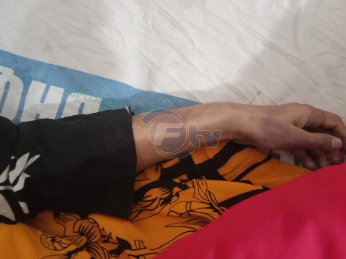 FSDTv41's tweet photo. 10 سالہ بچی جس کا مکمل نام عائشہ مصطفٰی تھا وہ مکان نمبر ۔۔۔۔ ، نعمت کالونی نمبر 2 تیزاب مل جڑانوالہ روڈ میں کسی کے گھر پر کام کرتی تھی۔ بچی پر بدترین تشدد کیا گیا جس سے اس کی موت واقع ہوگئی۔ بچی کے چہرے، 2 بازوں اور ٹانگوں پر تشدد کے نشانات موجود ہیں۔ جو کہ تصویروں میں بھی دیکھے جا سکتے ہیں۔
#Faisalabad #FaisalabadTV #FsdTV41 #ChildAbuse #Children #Police #PoliceNews #CrimeNews #Childrens
