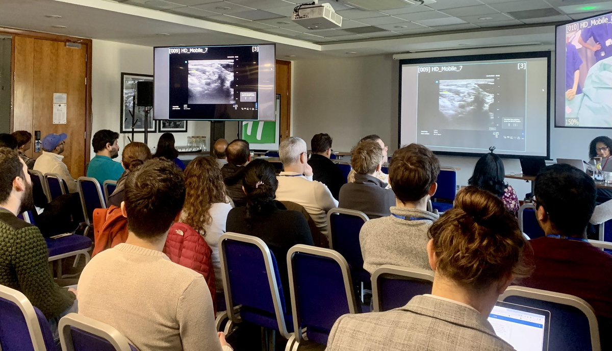East Surrey Regional (@eastsurreyra) on Twitter photo Today has been jam packed with Live Interactive Demos from theatres to show a range of regional blocks in practice in real time!
Thank you <a href="/ESRA_Society/">ESRA | European Society of Regional Anaesthesia</a> <a href="/RegionalAnaesUK/">RA-UK</a> <a href="/ATredray/">Aasifa Tredray</a> <a href="/drvenkatd/">Venkatesan Duraiswamy</a>
#ESRAC2024 #RegionalAnaesthesia Today has been jam packed with Live Interactive Demos from theatres to show a range of regional blocks in practice in real time!
Thank you <a href="/ESRA_Society/">ESRA | European Society of Regional Anaesthesia</a> <a href="/RegionalAnaesUK/">RA-UK</a> <a href="/ATredray/">Aasifa Tredray</a> <a href="/drvenkatd/">Venkatesan Duraiswamy</a>
#ESRAC2024 #RegionalAnaesthesia