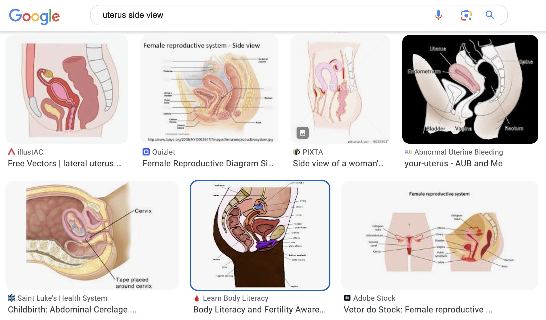 Side and bottom views of the female urinary tract - Media Asset