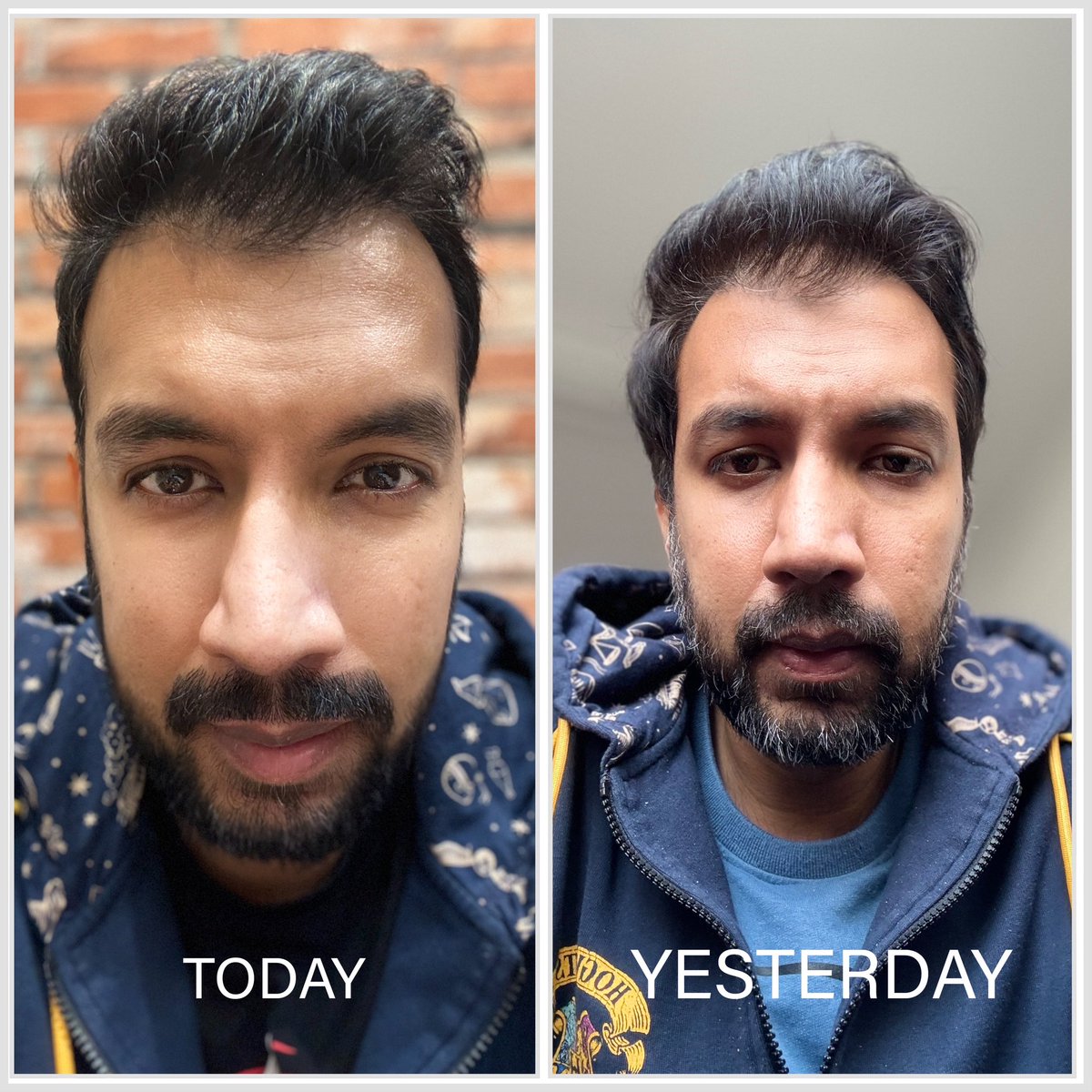 AnkitChowdhry's tweet photo. Got a haircut after what felt like ages. Never realized in used to look like an oldie. https://t.co/0cSEzPIyqP