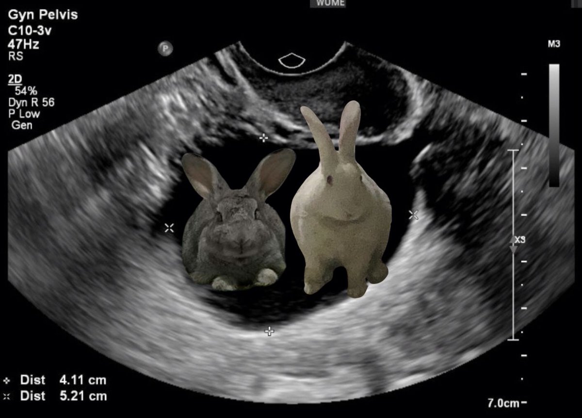 al___essa's tweet image. wym