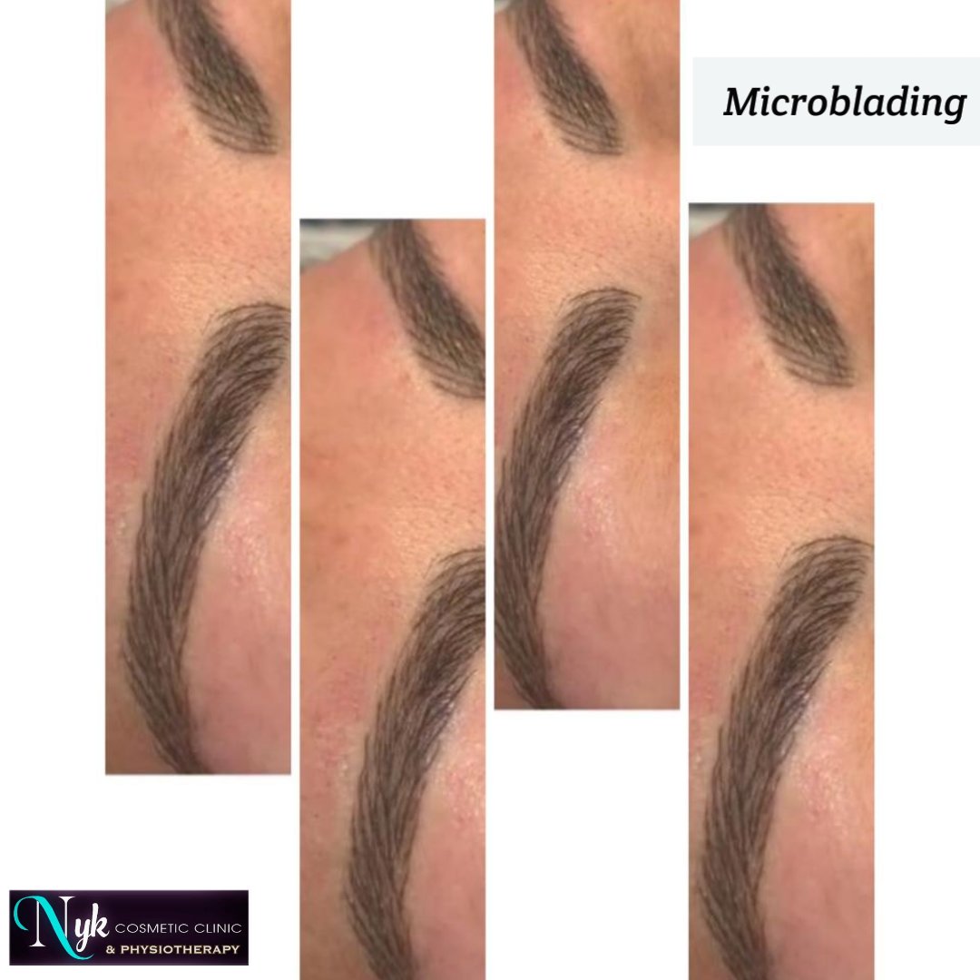 Microblading❤️ at 👉 @nykcosmetic.clinic

.
.
.

#microblading #permanentmakeup #brows #eyebrows #pmu #beauty #makeup #microshading #phibrows #micropigmentation #ombrebrows #microbladingeyebrows #phibrows #nykcosmeticclinic #nykcosmeticclinic&physio #brampton #mississaugaontario