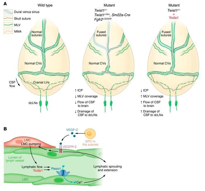 Journal of Clinical Investigation (@jclinicalinvest) on Twitter photo #Commentary:
Yoda1 opens the lymphatic path for craniosynostosis therapy: buff.ly/4bNBRWH
<a href="/aleaspel/">Aleksanteri Aspelund</a> and Kari Alitalo <a href="/helsinkiuni/">University of Helsinki</a>
Related article: buff.ly/48qnvbV #Commentary:
Yoda1 opens the lymphatic path for craniosynostosis therapy: buff.ly/4bNBRWH
<a href="/aleaspel/">Aleksanteri Aspelund</a> and Kari Alitalo <a href="/helsinkiuni/">University of Helsinki</a>
Related article: buff.ly/48qnvbV