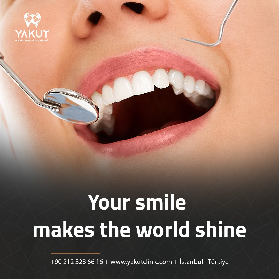 YakutDent's tweet photo. At #Yakut_dental_clinic, we provide great results making your teeth and smile more appealing. 
Make your free appointment now:
00902125236616 
#yakutdent #DentalImplants #OralHealth #hollywoodsmile #veneers #dentist #smile #dentistry #dental #DentalCare #23point5 #winpw #deprem https://t.co/g84kwc42oM