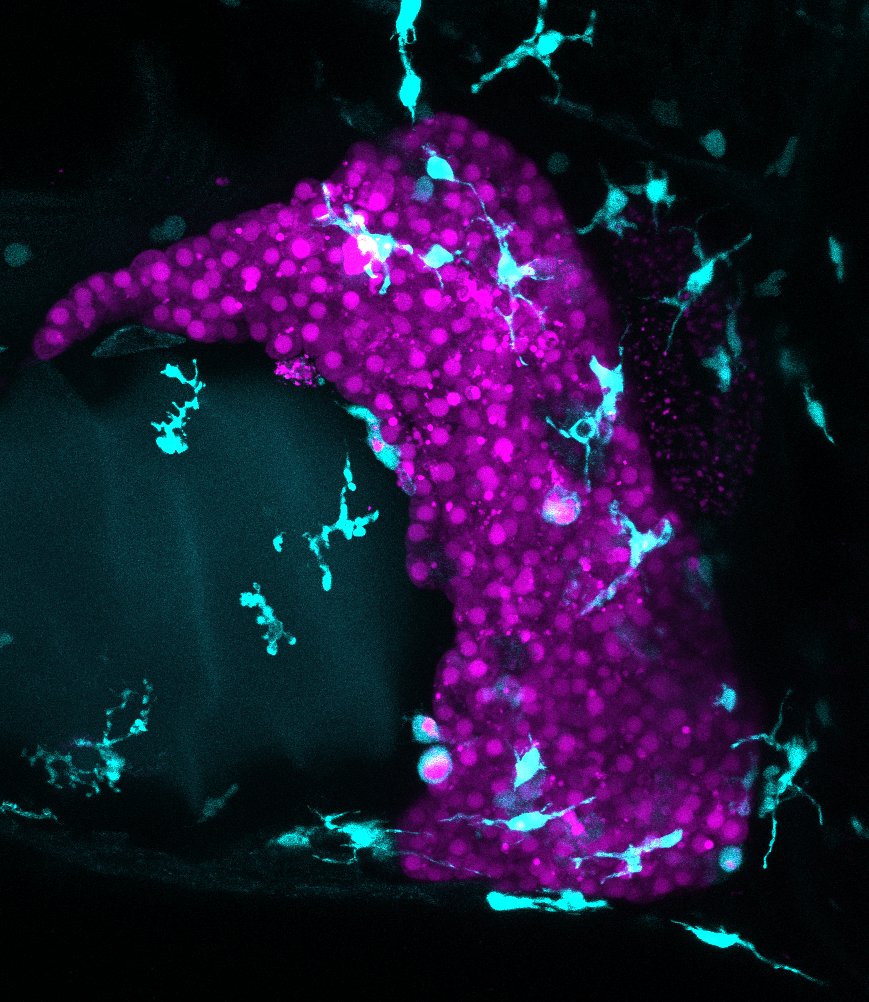 Sumeet Pal Singh (@sumeetpalsingh8) on Twitter photo Macrophages, in cyan, clearing dead hepatocytes, in magenta. Image by <a href="/macotaa/">Macarena Pozo-Morales</a> . #FluorescentFridays Macrophages, in cyan, clearing dead hepatocytes, in magenta. Image by <a href="/macotaa/">Macarena Pozo-Morales</a> . #FluorescentFridays